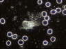 Dendritic WBC